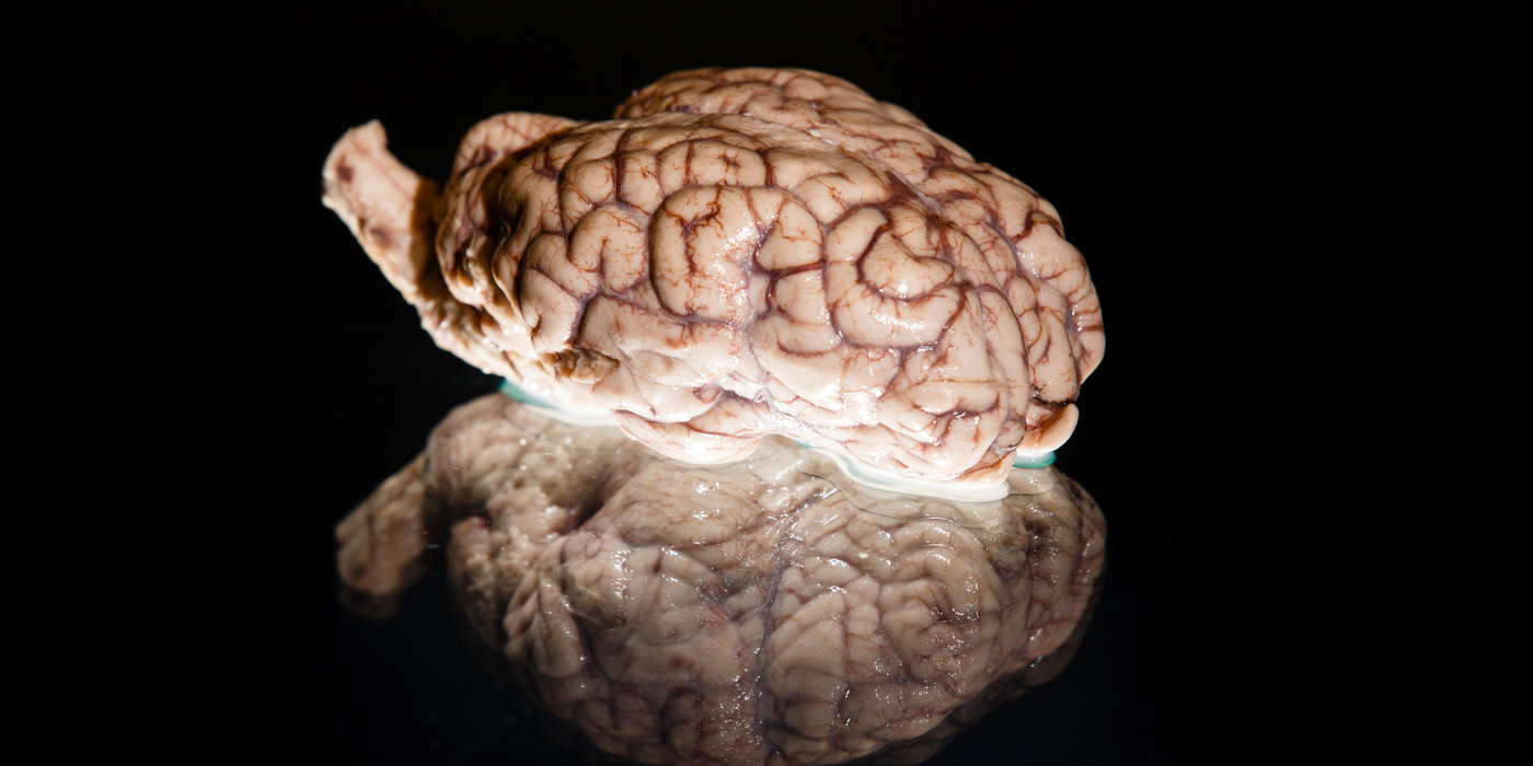 A sheep's brain used by Robin Willenbring as part of her work with Brainwaves.